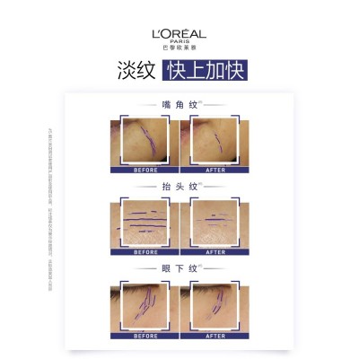 欧莱雅紫熨斗眼霜保湿抗皱提拉紧致淡化细纹秋冬季图4